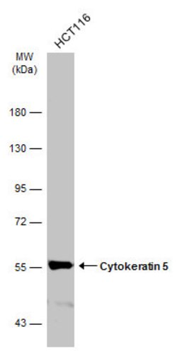 Invitrogen Cytokeratin 5 Monoclonal Antibody (GT1486) 100 &mu;L; Unconjugated:Antibodies,