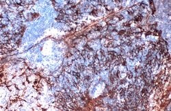 Invitrogen Cytokeratin 5 Monoclonal Antibody (GT1486) 100 &mu;L; Unconjugated:Antibodies,