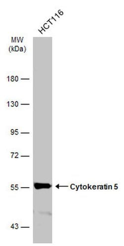 Invitrogen Cytokeratin 5 Monoclonal Antibody (GT1486) 100 &mu;L; Unconjugated:Antibodies,
