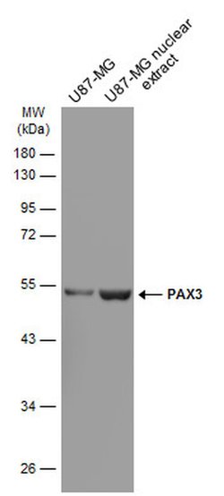 Invitrogen PAX3 Monoclonal Antibody (GT2411) 100 &mu;L; Unconjugated:Antibodies,