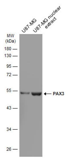 Invitrogen PAX3 Monoclonal Antibody (GT2411) 100 &mu;L; Unconjugated:Antibodies,