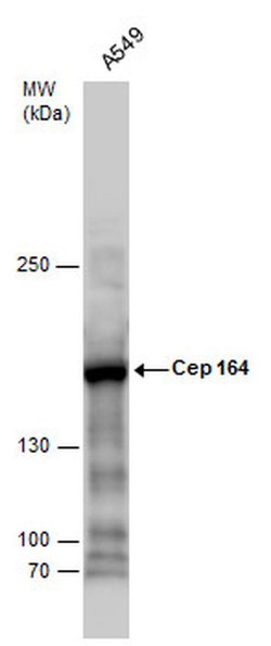Invitrogen CEP164 Monoclonal Antibody (17) 100 &mu;L; Unconjugated:Antibodies,