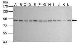 Invitrogen Ku80 Monoclonal Antibody (149.8) 100 &mu;L; Unconjugated:Antibodies,