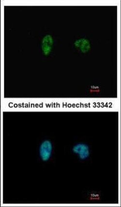 Invitrogen CHK2 Monoclonal Antibody (8F12) 100 &mu;L; Unconjugated:Antibodies,