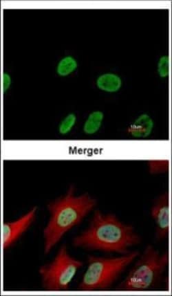 Invitrogen Ku70 Monoclonal Antibody (529) 100 &mu;L; Unconjugated:Antibodies,