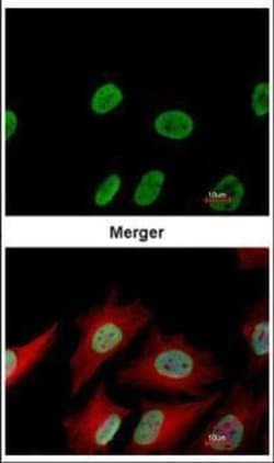 Invitrogen Ku70 Monoclonal Antibody (529) 100 &mu;L; Unconjugated:Antibodies,