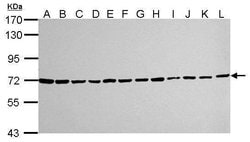 Invitrogen Ku70 Monoclonal Antibody (529) 100 &mu;L; Unconjugated:Antibodies,
