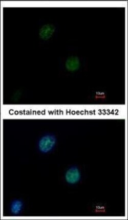 Invitrogen ATM Monoclonal Antibody (2C1) 1 mL; Unconjugated:Antibodies,