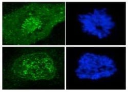 Invitrogen CENPF Monoclonal Antibody (7F11.2) 100 &mu;L; Unconjugated:Antibodies,