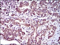 Invitrogen ABCG5 Monoclonal Antibody (1B5E10) 100 &mu;L; Unconjugated:Antibodies,
