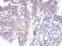 Invitrogen ALDH6A1 Monoclonal Antibody (6H9B8) 100 &mu;L; Unconjugated:Antibodies,