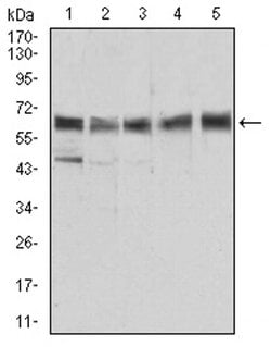 Invitrogen ALDH6A1 Monoclonal Antibody (6H9B8) 100 &mu;L; Unconjugated:Antibodies,
