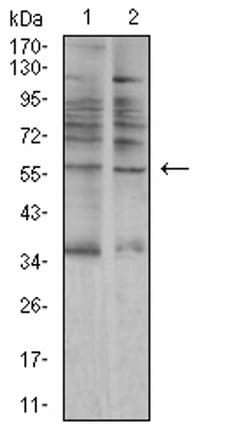 Invitrogen alpha Amylase 1 Monoclonal Antibody (5G6F7) 100 &mu;L; Unconjugated:Antibodies,
