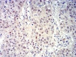 Invitrogen BCL11B Monoclonal Antibody (1F8G8) 100 &mu;L; Unconjugated:Antibodies,