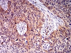 Invitrogen BIN1 Monoclonal Antibody (3B6F10) 100 &mu;L; Unconjugated:Antibodies,