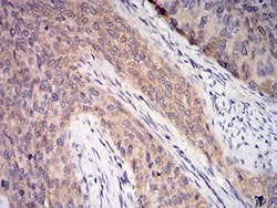 Invitrogen C1QA Monoclonal Antibody (8B5B1) 100 &mu;L; Unconjugated:Antibodies,