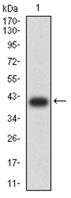 Invitrogen C1QA Monoclonal Antibody (8B5B1) 100 &mu;L; Unconjugated:Antibodies,