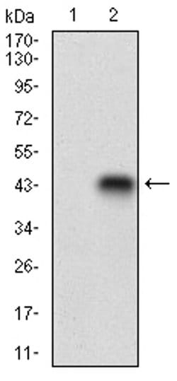 Invitrogen CDX1 Monoclonal Antibody (1B11A9) 100 &mu;L | Buy Online | Invitrogen&trade; | Fisher Scientific