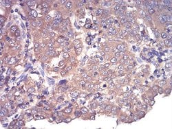 Invitrogen CFHR5 Monoclonal Antibody (3E1E10) 100 &mu;L; Unconjugated:Antibodies,