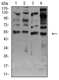 Invitrogen CHRNA7 Monoclonal Antibody (7F10F1) 100 &mu;L; Unconjugated:Antibodies,