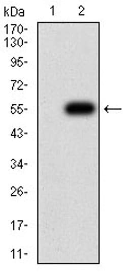 Invitrogen CHRND Monoclonal Antibody (1H1F9) 100 &mu;L; Unconjugated:Antibodies,