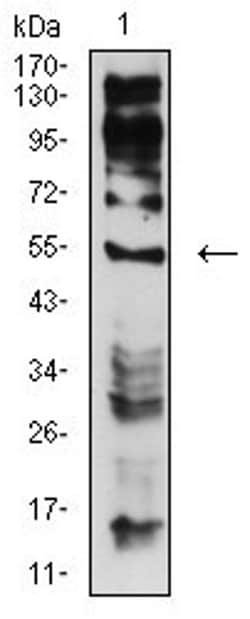 Invitrogen CHRNE Monoclonal Antibody (5F11G8) 100 &mu;L; Unconjugated:Antibodies,