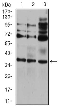Invitrogen CIDEC Monoclonal Antibody (7C12F11) 100 &mu;L; Unconjugated:Antibodies,
