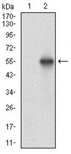 Invitrogen CK2 beta Monoclonal Antibody (2F12F3) 100 &mu;L | Buy Online | Invitrogen&trade; | Fisher Scientific
