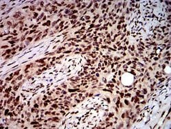 Invitrogen DDX1 Monoclonal Antibody (3E5B2) 100 &mu;L; Unconjugated:Antibodies,