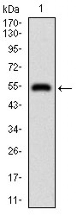 Invitrogen DIS3L2 Monoclonal Antibody (6C7B2) 100 &mu;L; Unconjugated:Antibodies,