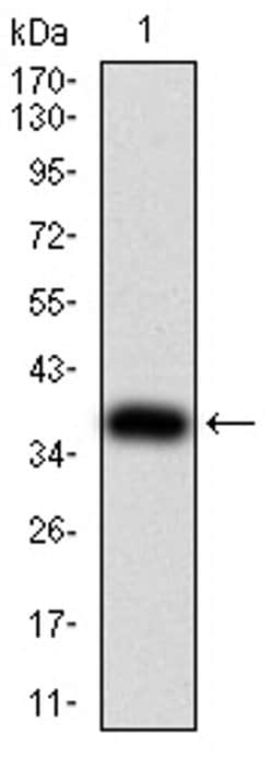 Invitrogen FOXP2 Monoclonal Antibody (2G11B8) 100 &mu;L; Unconjugated:Antibodies,