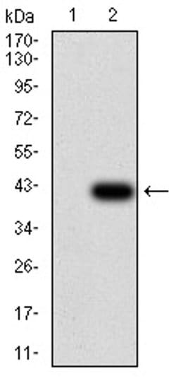Invitrogen FOXP2 Monoclonal Antibody (2G11B8) 100 &mu;L; Unconjugated:Antibodies,