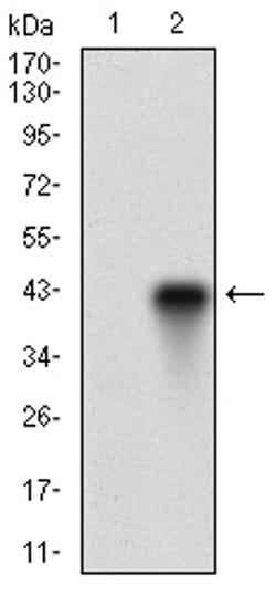 Invitrogen FUT4 Monoclonal Antibody (6B11B4) 100 &mu;L; Unconjugated:Antibodies,