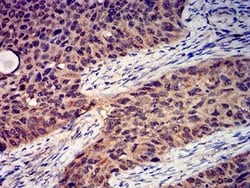 Invitrogen GRIK4 Monoclonal Antibody (8H5H9) 100 &mu;L; Unconjugated:Antibodies,