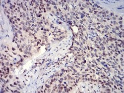 Invitrogen H3K27ac Monoclonal Antibody (6E7A9) 100 &mu;L; Unconjugated:Antibodies,