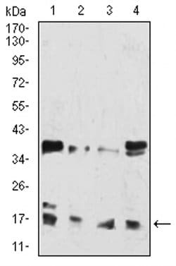 Invitrogen H3K27ac Monoclonal Antibody (6E7A9) 100 &mu;L; Unconjugated:Antibodies,