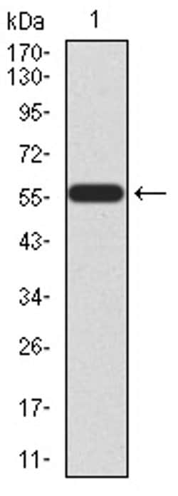 Invitrogen HOXA9 Monoclonal Antibody (1A12C1) 100 &mu;L; Unconjugated:Antibodies,
