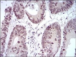 Invitrogen HOXB4 Monoclonal Antibody (3A2F2) 100 &mu;L; Unconjugated:Antibodies,