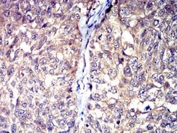 Invitrogen HTR3A Monoclonal Antibody (3B11C10) 100 &mu;L; Unconjugated:Antibodies,
