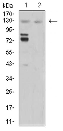 Invitrogen MIB1 Monoclonal Antibody (2A7B1) 100 &mu;L; Unconjugated:Antibodies,