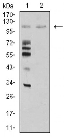 Invitrogen MIB1 Monoclonal Antibody (6A9C9) 100 &mu;L; Unconjugated:Antibodies,