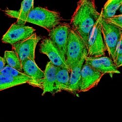 Invitrogen MURF1 Monoclonal Antibody (7B8E1) 100 &mu;L; Unconjugated:Antibodies,