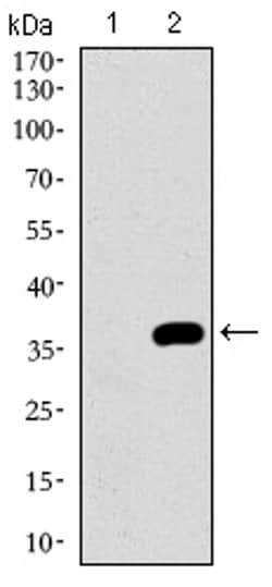 Invitrogen NRCAM Monoclonal Antibody (7D8C5) 100 &mu;L; Unconjugated:Antibodies,