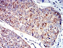 Invitrogen P2Y1 Monoclonal Antibody (4G5B7) 100 &mu;L; Unconjugated:Antibodies,