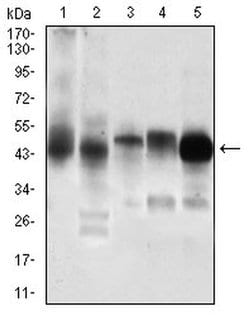 Invitrogen PDK2 Monoclonal Antibody (3F2D7) 100 &mu;L; Unconjugated:Antibodies,