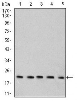 Invitrogen RAB6B Monoclonal Antibody (6D12G9) 100 &mu;L; Unconjugated:Antibodies,