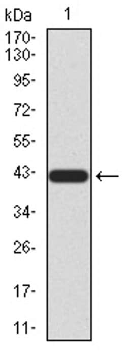 Invitrogen RAD23A Monoclonal Antibody (1E4D6) 100 &mu;L; Unconjugated:Antibodies,
