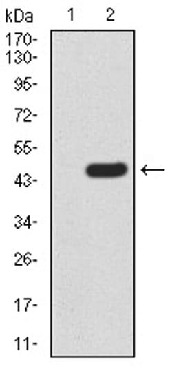 Invitrogen RAD23A Monoclonal Antibody (1E4D6) 100 &mu;L; Unconjugated:Antibodies,