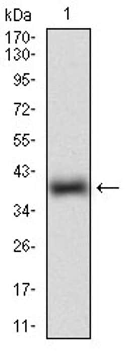 Invitrogen ROR2 Monoclonal Antibody (6F2D10) 100 μL; Unconjugated:Antibodies,