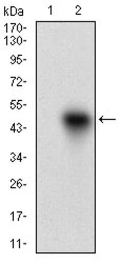 Invitrogen ROR2 Monoclonal Antibody (6F2D10) 100 μL; Unconjugated:Antibodies,